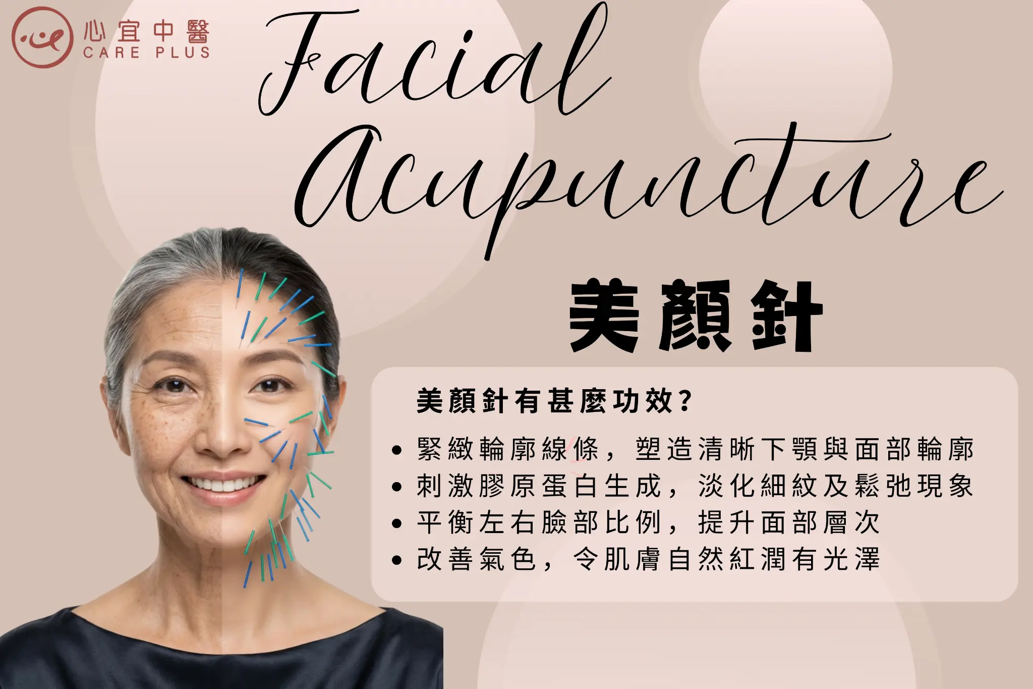 美顏針