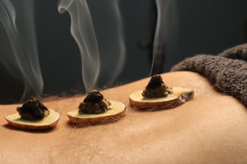 月經不調治療